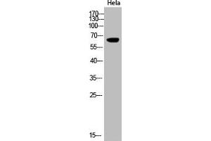 Western Blot analysis of Hela cells using Acetyl-Cytokeratin-pan (K194) Polyclonal Antibody (KRT2/KRT76/KRT3/KRT5/KRT6A/KRT6B/KRT6C/KRT71/KRT72/KRT73/KRT74/KRT75/KRT79/KRT7/KRT8/KRT84 (acLys194) antibody)