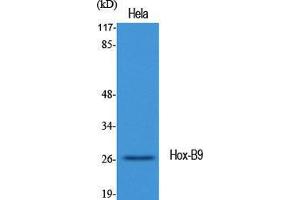 Western Blotting (WB) image for anti-Homeobox B9 (HOXB9) (C-Term) antibody (ABIN3185075) (HOXB9 antibody  (C-Term))