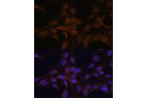 Immunofluorescence analysis of C6 cells using Y antibody (ABIN6132787, ABIN6150315, ABIN6150320 and ABIN6214108) at dilution of 1:100. (YAP1 antibody  (AA 155-504))