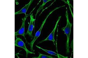 Immunofluorescence analysis of SK-BR-3 cells using PTH1R mouse mAb (green). (PTH1R antibody)