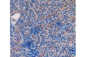 Used in DAB staining on fromalin fixed paraffin-embedded Kidney tissue (CD166 antibody  (AA 28-527))
