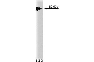 Western blot analysis of EFG-R on A431 cell lysate. (EGFR antibody  (AA 1020-1046))
