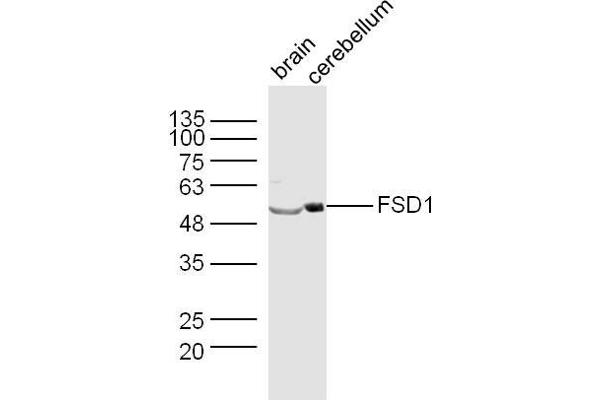 FSD1 抗体  (AA 421-496)
