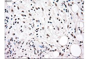 Immunohistochemical staining of paraffin-embedded colon tissue using anti-RAD9Amouse monoclonal antibody. (RAD9A antibody)