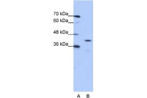 WB Suggested Anti-CPEB2 Antibody Titration:  0. (CPEB2 antibody  (Middle Region))