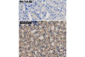 Immunohistochemistry (IHC) image for anti-CD4 (CD4) antibody (ABIN6254232)