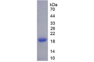 SDS-PAGE (SDS) image for Dipeptidyl-Peptidase 4 (DPP4) ELISA Kit (ABIN6574232)