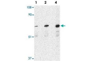 Western blot analysis of PAK6 in Raji lysate with PAK6 polyclonal antibody  at 1, 2, and 4 ug/mL . (PAK6 antibody  (Internal Region))