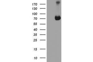 HEK293T cells were transfected with the pCMV6-ENTRY control (Left lane) or pCMV6-ENTRY ATIC (Right lane) cDNA for 48 hrs and lysed. (ATIC antibody)