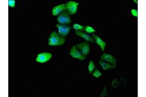 Immunofluorescence staining of Hela cells with ABIN7139783 at 1:180, counter-stained with DAPI. (COL6A1 antibody  (AA 64-80))