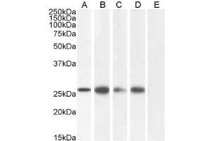 ABIN190896 (1µg/ml) staining of Human Colon (A), Heart (B), Prostate (C), Skin (D) and negative control Adipose (E) lysate (35µg protein in RIPA buffer). (GJB2 antibody  (C-Term))