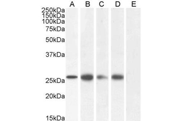 GJB2 anticorps  (C-Term)