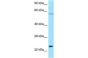 WB Suggested Anti-Rac2 Antibody Titration: 1. (RAC2 antibody  (C-Term))