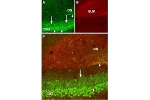 Expression of GABA(B) receptor 1 in mouse hippocampus - Immunohistochemical staining of mouse hippocampus frozen sections using Anti-GABA(B) R1 (extracellular) Antibody (ABIN7043195, ABIN7044319 and ABIN7044320), (1:100). (GABBR1 antibody  (Extracellular))