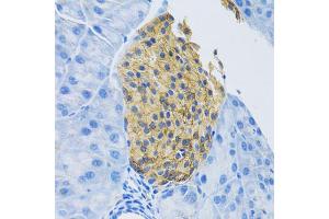 Immunohistochemistry of paraffin-embedded mouse pancreas using SLC1A2 antibody (ABIN5995519) at dilution of 1/100 (40x lens). (SLC1A2 antibody)
