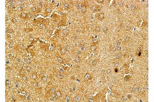 ABIN6260069 and ABIN6278660 at 1/100 staining rat brain tissue by IHC-P.