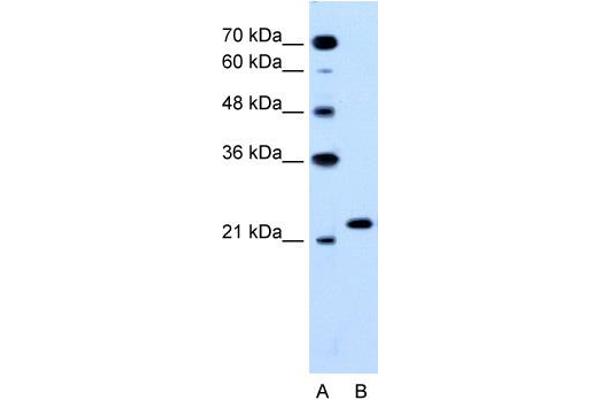 RAB14 Antikörper  (C-Term)