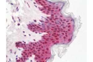 Anti-ETV6 / TEL antibody IHC staining of human skin. (ETV6 antibody  (AA 84-111))