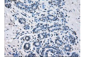 Immunohistochemical staining of paraffin-embedded breast tissue using anti-SORD mouse monoclonal antibody. (SORD antibody)