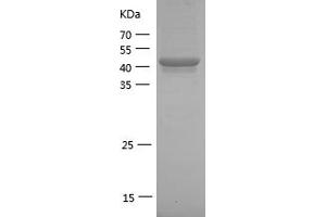 Western Blotting (WB) image for Interleukin-1 Receptor-Associated Kinase 1 (IRAK1) (AA 504-712) protein (GST tag) (ABIN7281788) (IRAK1 Protein (AA 504-712) (GST tag))