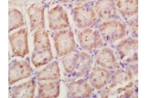 Formalin-fixed and paraffin embedded mouse intestine labeled with Anti-RPLP0 Polyclonal Antibody, Unconjugated  at 1:200 followed by conjugation to the secondary antibody and DAB staining (RPLP0 antibody  (AA 221-317))