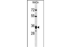 Western blot analysis in WiDr cell line lysates (35ug/lane). (HMGCL antibody  (AA 161-190))