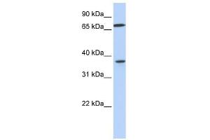 MAP2K3 antibody used at 1 ug/ml to detect target protein. (MAP2K3 antibody  (C-Term))