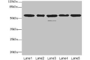 Western blot All lanes: RBBP4 antibody at 1 μg/mL Lane 1: Hela whole cell lysate Lane 2: LO2 whole cell lysate Lane 3: K562 whole cell lysate Lane 4: NIH/3T3 whole cell lysate Lane 5: Raji whole cell lysate Secondary Goat polyclonal to rabbit IgG at 1/10000 dilution Predicted band size: 48, 47, 44 kDa Observed band size: 48, 55 kDa (Retinoblastoma Binding Protein 4 antibody  (AA 246-425))