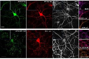 Effect of Shank3 on localization of δ-catenin in neurons. (MAP2 antibody)