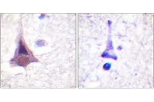 Immunohistochemistry analysis of paraffin-embedded human brain tissue, using MYPT1 (Ab-853) Antibody. (PPP1R12A antibody  (AA 621-670))