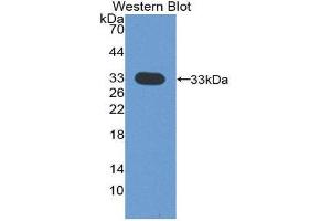 Western Blotting (WB) image for anti-Cyclin-Dependent Kinase 4 (CDK4) (AA 6-295) antibody (ABIN1858347) (CDK4 antibody  (AA 6-295))