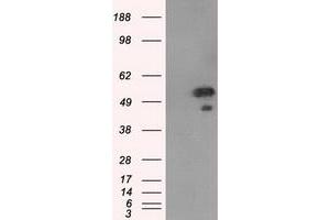 Western Blotting (WB) image for anti-SHC (Src Homology 2 Domain Containing) Transforming Protein 1 (SHC1) antibody (ABIN1499993) (SHC1 antibody)