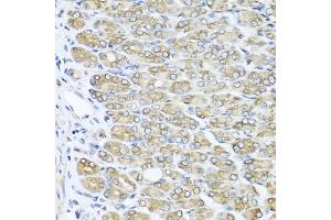 Immunohistochemistry of paraffin-embedded mouse stomach using RAC2 antibody (ABIN5970487) at dilution of 1/100 (40x lens). (RAC2 antibody)