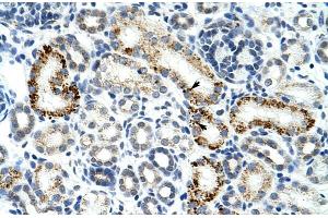 Human Kidney; Rabbit Anti-ZESR2 Antibody. (ZRSR2 antibody  (C-Term))