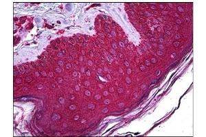 Immunohistochemistry (IHC) image for anti-Abhydrolase Domain Containing 5 (ABHD5) antibody (ABIN781986) (ABHD5 antibody)