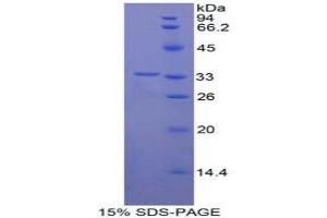 SDS-PAGE analysis of Human Contactin 1 Protein.