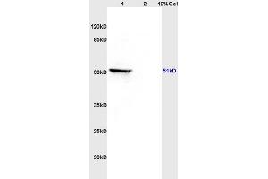 Lane 1: rat brain lysates Lane 2: rat heart lysates probed with Anti MAP3K8/TPL2 Polyclonal Antibody, Unconjugated (ABIN701275) at 1:200 in 4 °C. (MAP3K8 antibody  (AA 121-220))