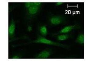 Immunostaining analysis in HeLa cells. (c-FOS antibody)