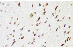 Immunohistochemistry of paraffin-embedded Rat brain using EDF1 Polyclonal Antibody at dilution of 1:100 (40x lens). (EDF1 antibody)