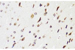 Immunohistochemistry of paraffin-embedded Rat brain using EDF1 Polyclonal Antibody at dilution of 1:100 (40x lens). (EDF1 antibody)