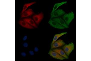 ABIN6257498 and ABIN6275600 staining Hela cells by IF/ICC. (Sorting Nexin 1 antibody  (Internal Region))