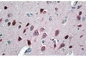 ABIN571065 (3. (Neurogranin antibody  (Internal Region))