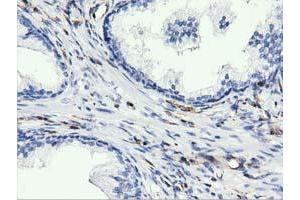 Immunohistochemical staining of paraffin-embedded Human liver tissue using anti-ARHGAP25 mouse monoclonal antibody.