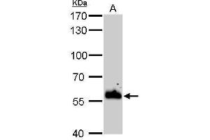 Western Blotting (WB) image for anti-Protein Disulfide Isomerase Family A, Member 3 (PDIA3) (C-Term) antibody (ABIN2854699)