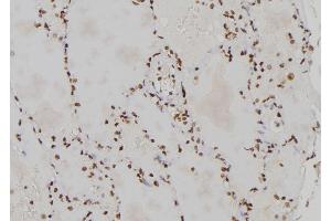 ABIN6273460 at 1/100 staining Human lung tissue by IHC-P. (CENPL antibody  (Internal Region))