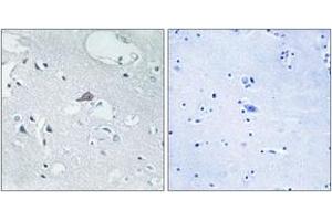 Immunohistochemistry analysis of paraffin-embedded human brain tissue, using OPRM1 Antibody. (Mu Opioid Receptor 1 antibody  (AA 21-70))