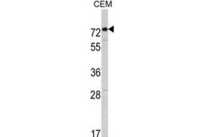 Western Blotting (WB) image for anti-Anti-Mullerian Hormone Receptor, Type II (AMHR2) antibody (ABIN3003000) (AMHR2 antibody)