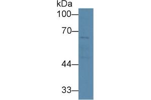 Detection of SERT in Human Liver lysate using Polyclonal Antibody to Serotonin Transporter (SERT) (SLC6A4 antibody  (AA 181-252))