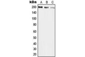 Western blot analysis of UBR2 expression in HepG2 (A), mouse liver (B), rat liver (C) whole cell lysates. (UBR2 antibody  (Center))