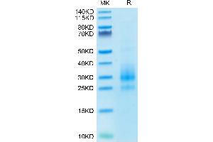 Cynomolgus NKG2C/CD159c on Tris-Bis PAGE under reduced conditions.